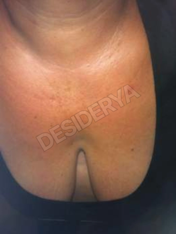 coppiacuriosabsx5515160