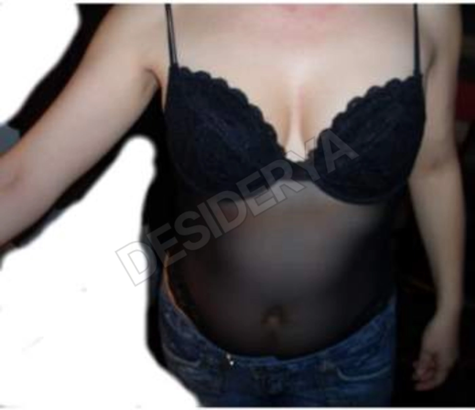 sole1005530847