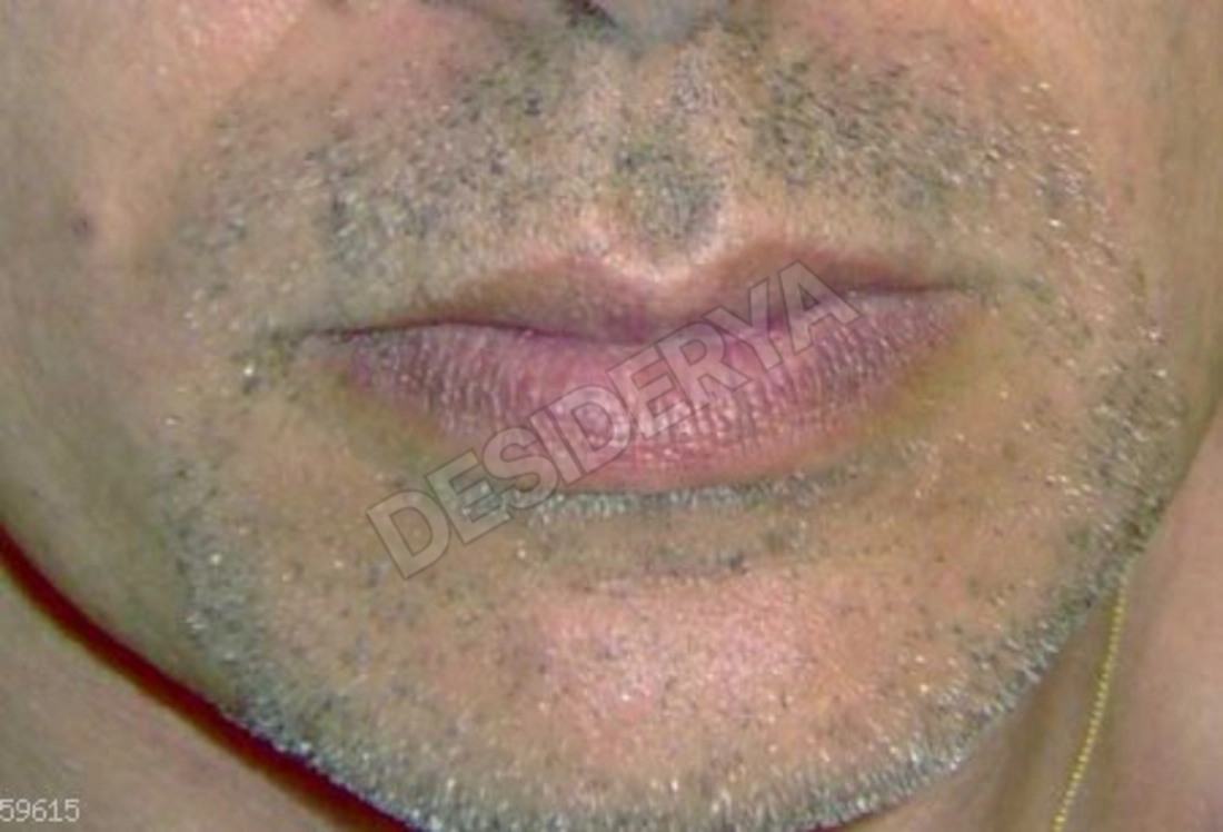 Pranomassaggiatore5303604