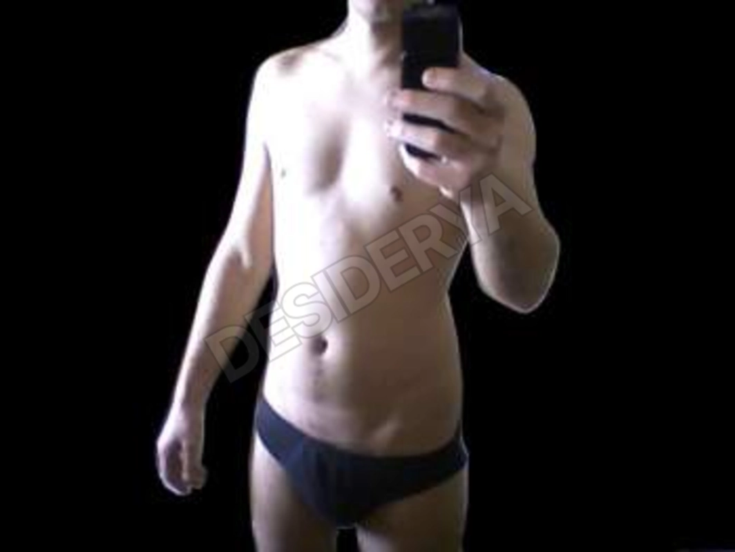 Marco20x165590674