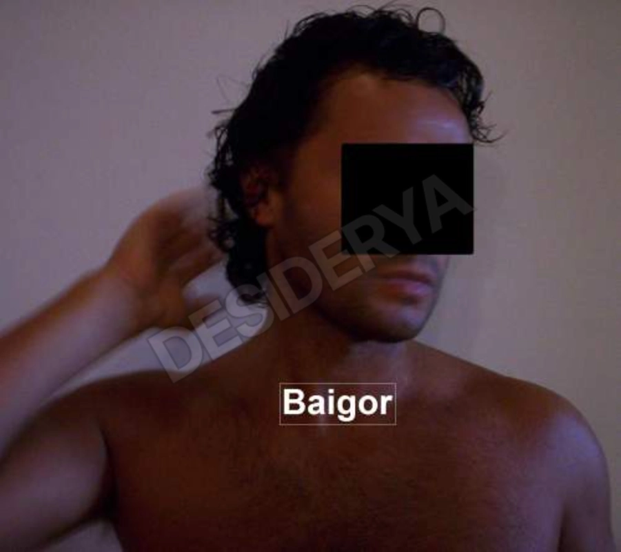 Baigor5523260