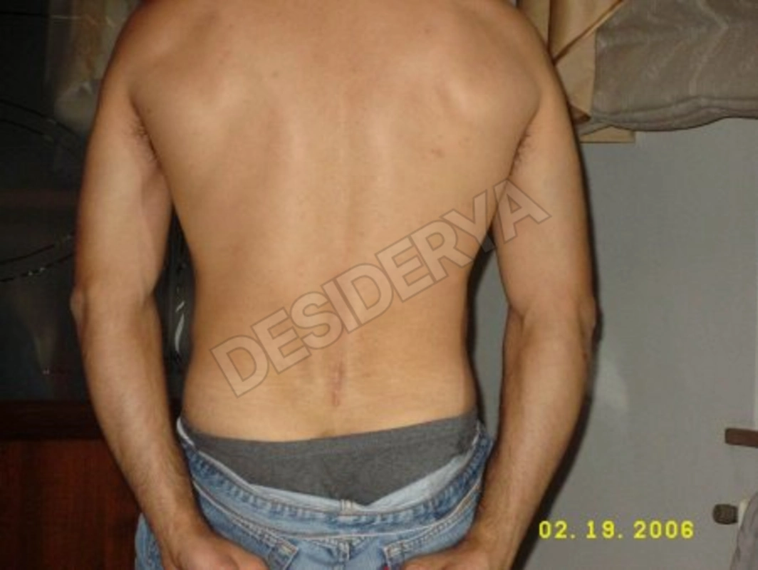 belmoro155306050