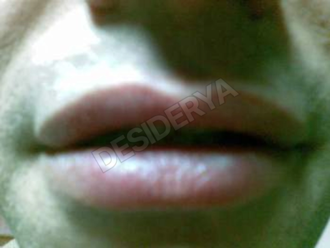 maxthebody5557485