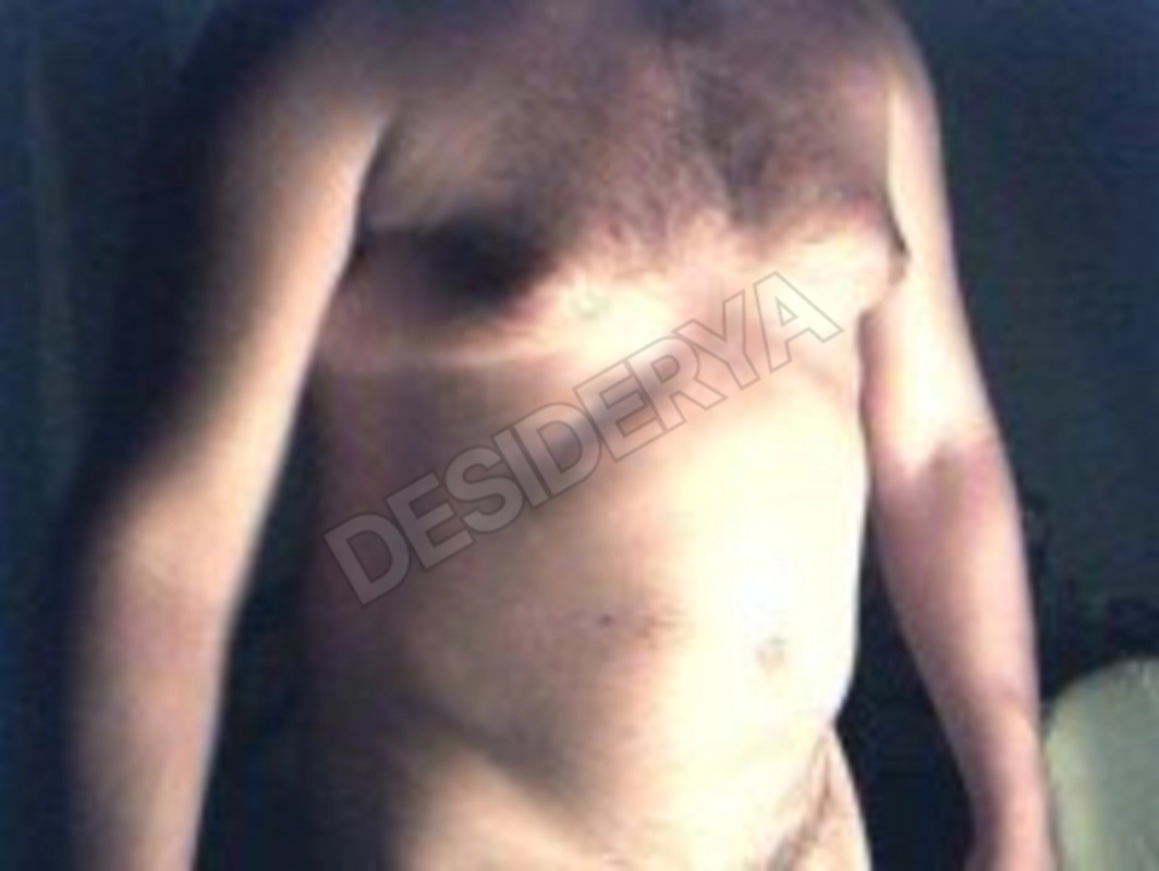 erosiltoro5328962