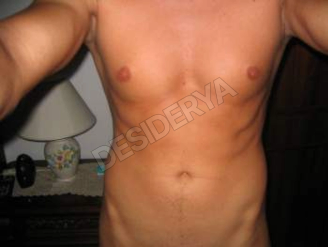 smilepg755515873