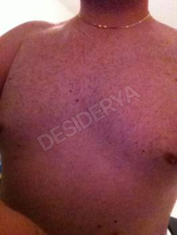 diomede25373685
