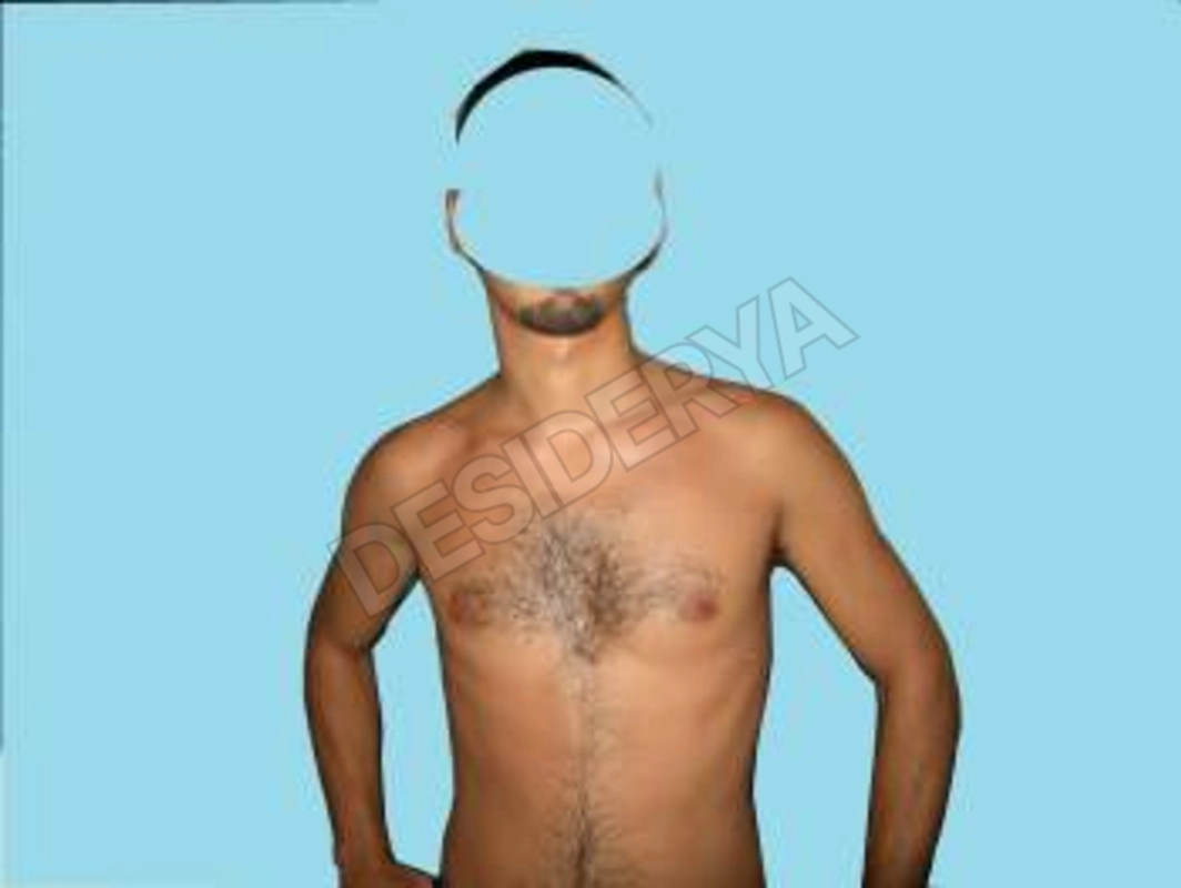 Alberto79va5562467