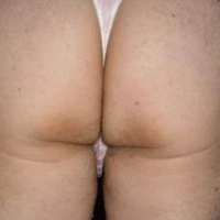 noani