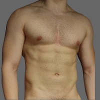 MrMuscleBoy