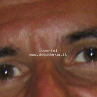 Ioperlei