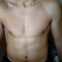 bellox