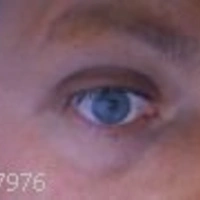 eyeice73