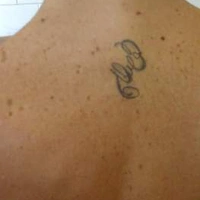 senza1complicazioni