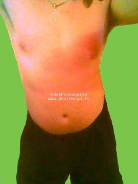 Ade30Prosespina