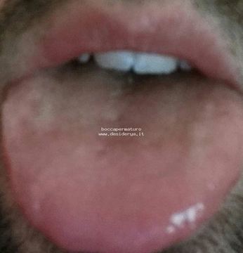 boccapermaturo
