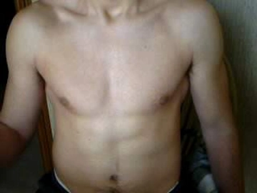 bellox