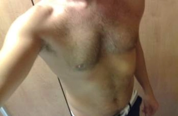 erotico77