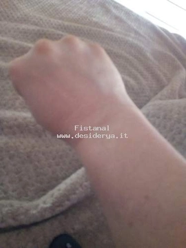 Fistanal