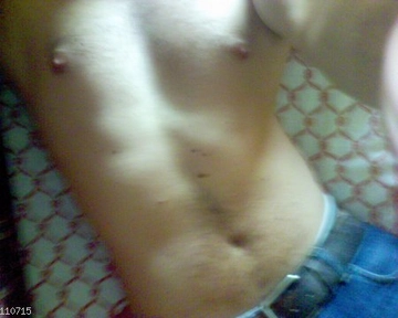 cercounculo