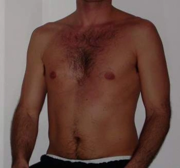 marcoblo