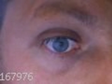 eyeice73