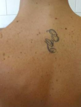 senza1complicazioni